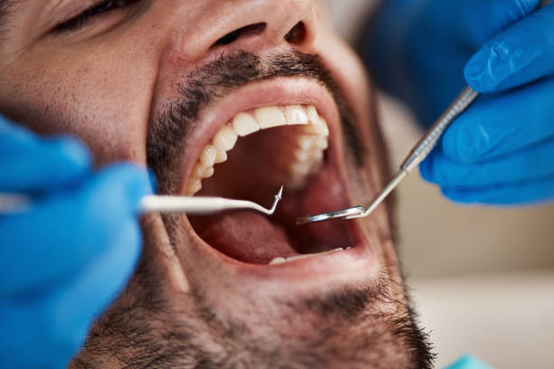Best Cosmetic Dentistry  in Moses Lake, WA